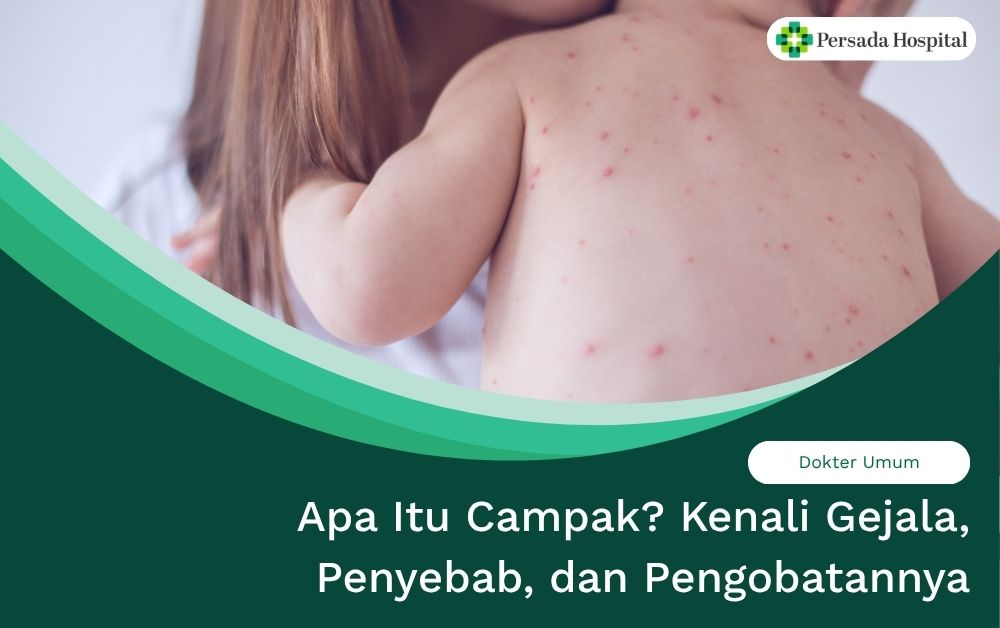 Apa Itu Campak? Kenali Gejala, Penyebab, dan Pengobatannya