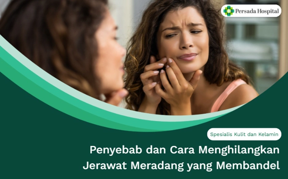 Penyebab dan Cara Menghilangkan Jerawat Meradang yang Membandel