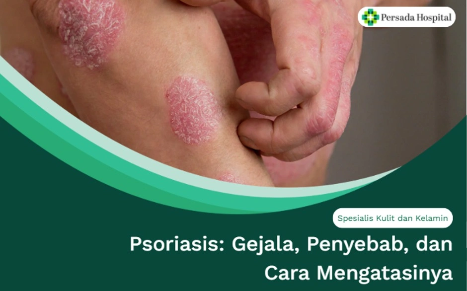 Psoriasis: Gejala, Penyebab, dan Cara Mengatasinya